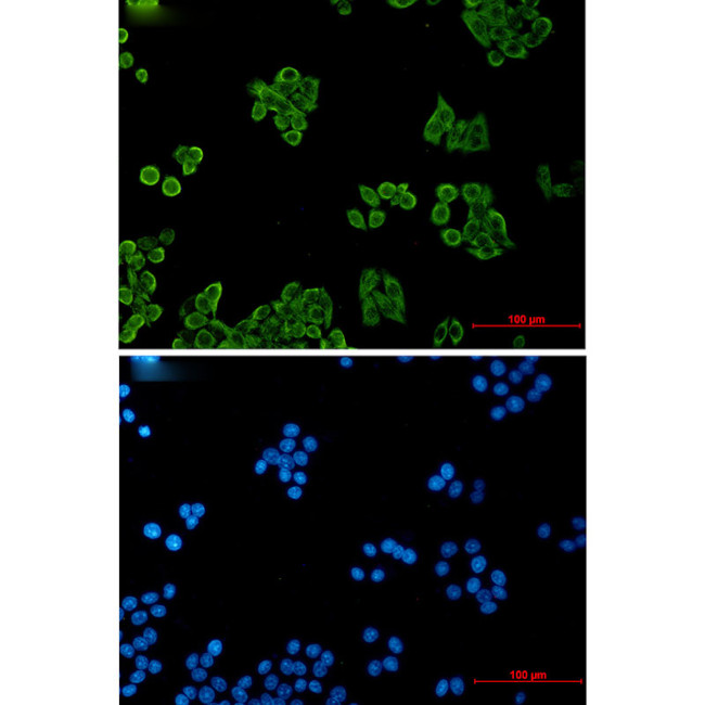 CSDE1 Antibody in Immunocytochemistry (ICC/IF)
