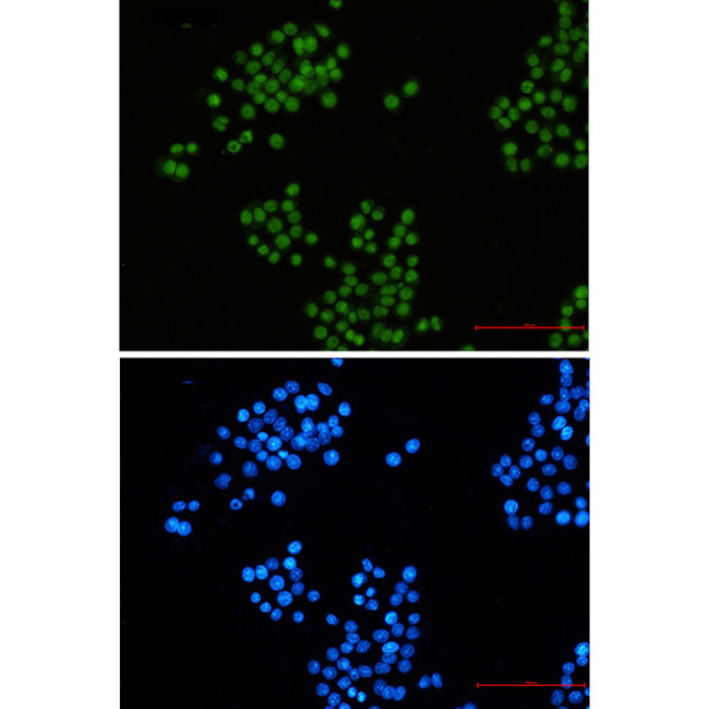 CtBP2 Antibody in Immunocytochemistry (ICC/IF)