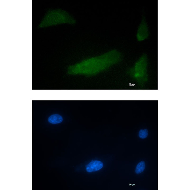 CUGBP1 Antibody in Immunocytochemistry (ICC/IF)