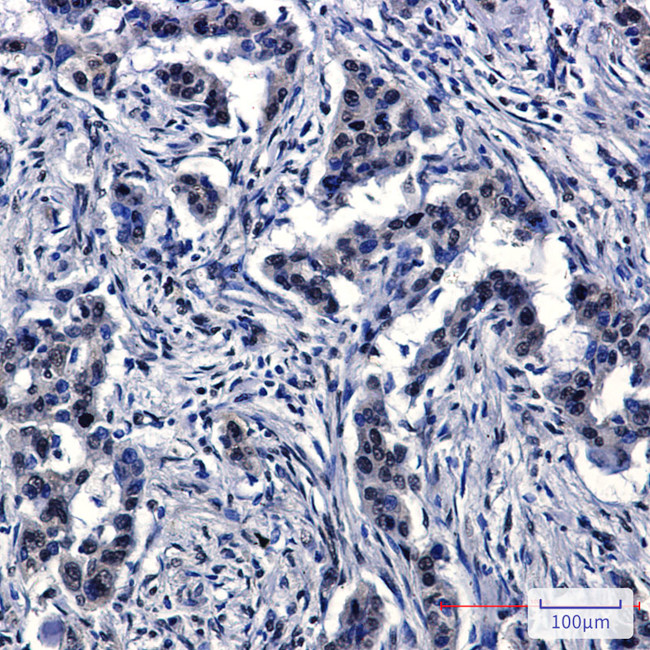 Cullin 4A Antibody in Immunohistochemistry (Paraffin) (IHC (P))