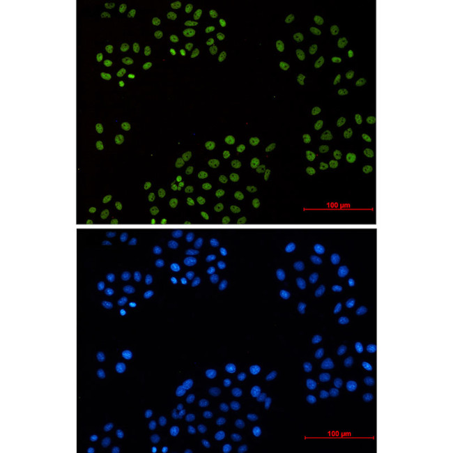 Cyclin H Antibody in Immunocytochemistry (ICC/IF)