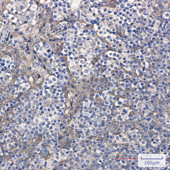 Cystatin B Antibody in Immunohistochemistry (Paraffin) (IHC (P))