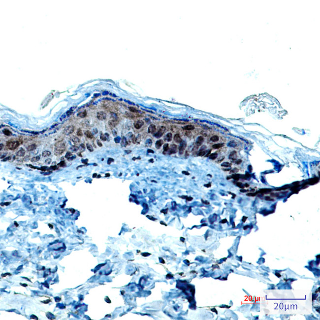 KRT9 Antibody in Immunohistochemistry (Paraffin) (IHC (P))