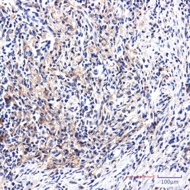 DAB2 Antibody in Immunohistochemistry (Paraffin) (IHC (P))
