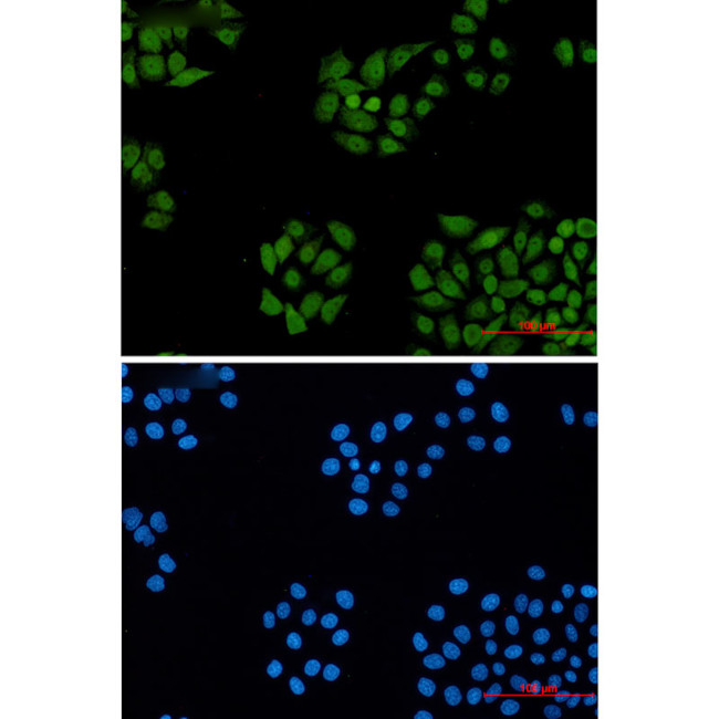 DDB1 Antibody in Immunocytochemistry (ICC/IF)