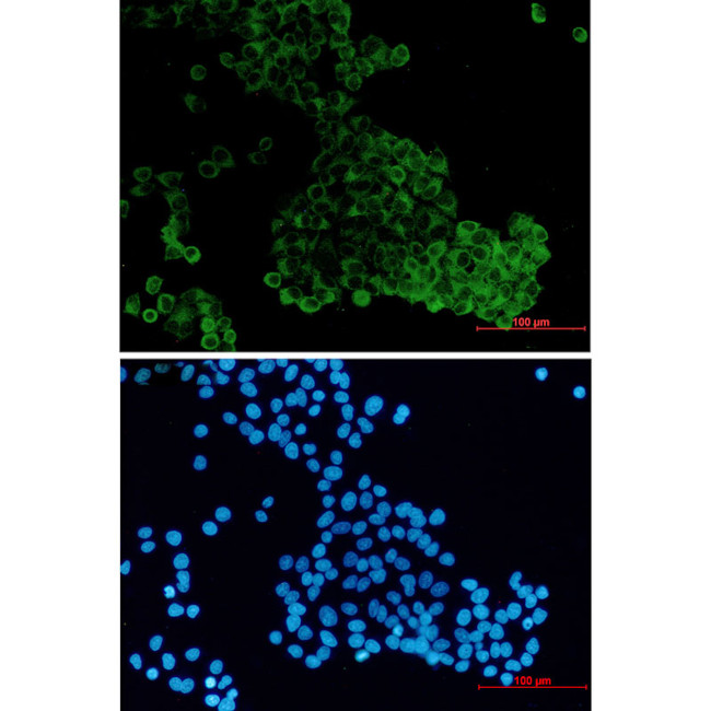 MADD Antibody in Immunocytochemistry (ICC/IF)