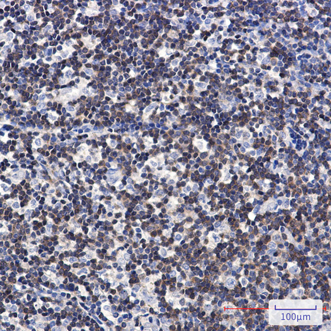 DGKA Antibody in Immunohistochemistry (Paraffin) (IHC (P))