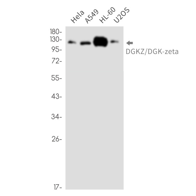DGKZ Antibody in Western Blot (WB)