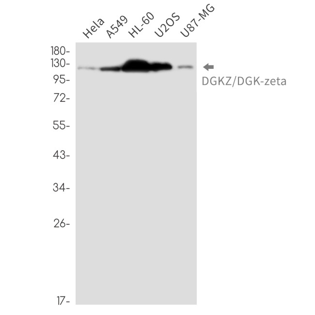 DGKZ Antibody in Western Blot (WB)