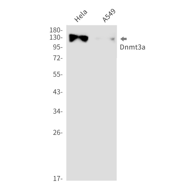 DNMT3A Antibody in Western Blot (WB)