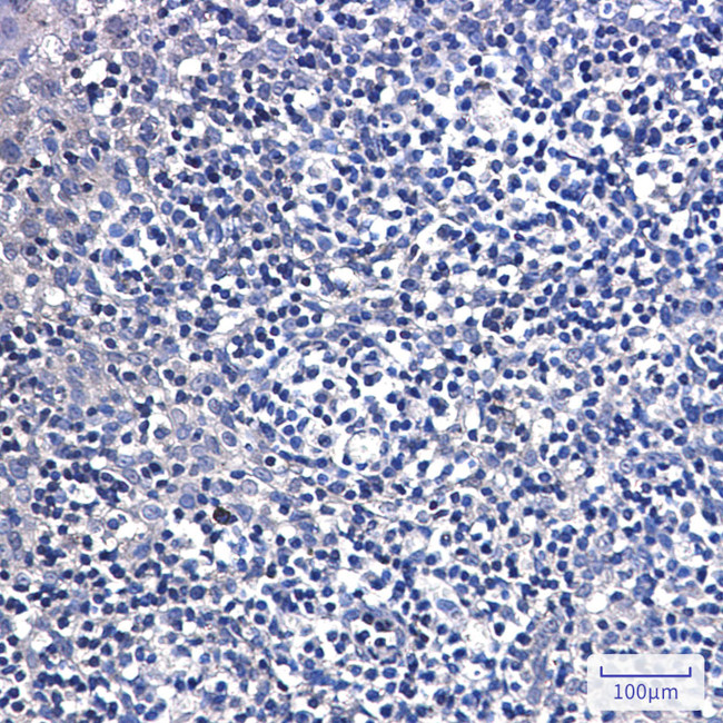 DTYMK Antibody in Immunohistochemistry (Paraffin) (IHC (P))