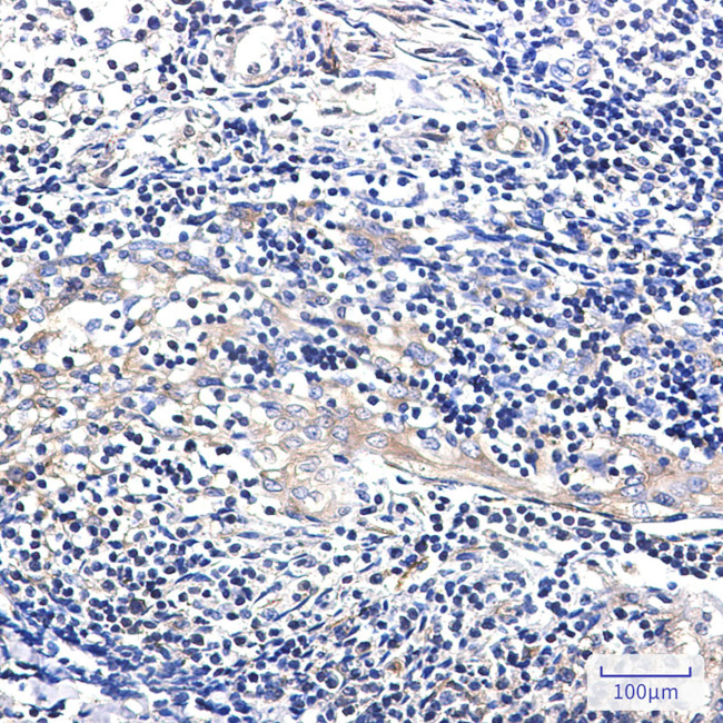 EBP1 Antibody in Immunohistochemistry (Paraffin) (IHC (P))