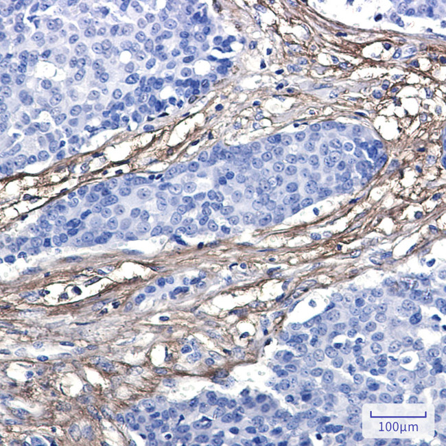 Fibulin 3 Antibody in Immunohistochemistry (Paraffin) (IHC (P))