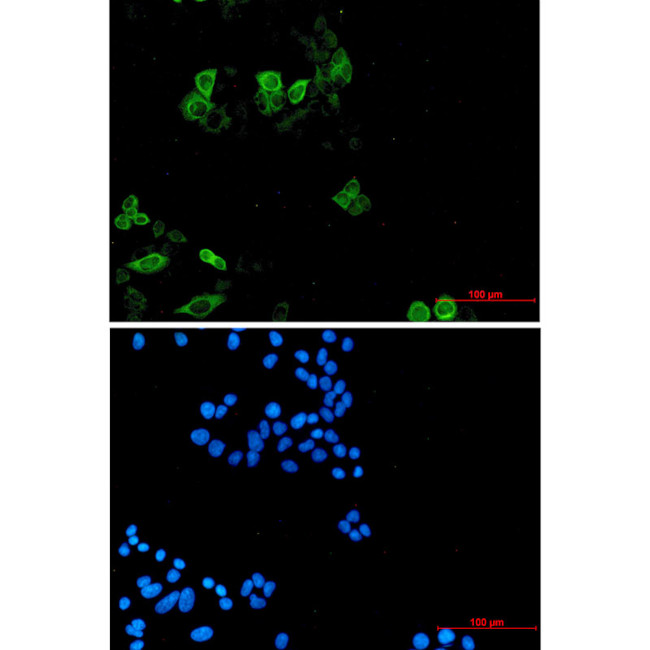 KIF11 Antibody in Immunocytochemistry (ICC/IF)
