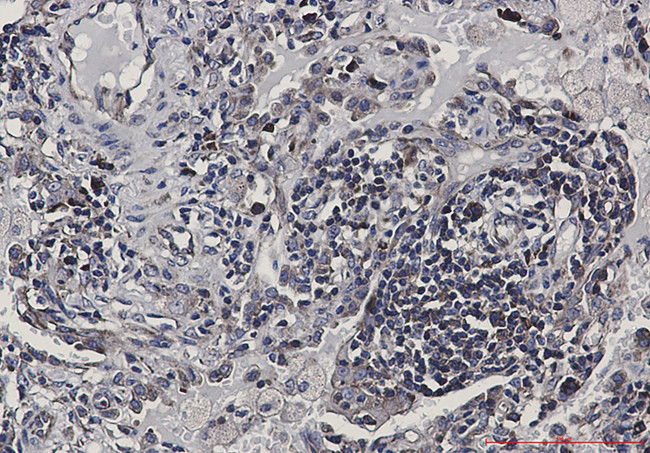eIF4B Antibody in Immunohistochemistry (Paraffin) (IHC (P))