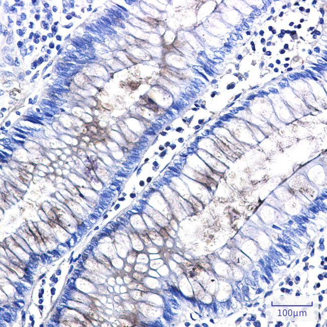 Nidogen Antibody in Immunohistochemistry (Paraffin) (IHC (P))