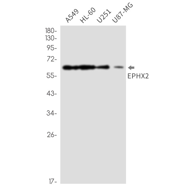 EPHX2 Antibody in Western Blot (WB)
