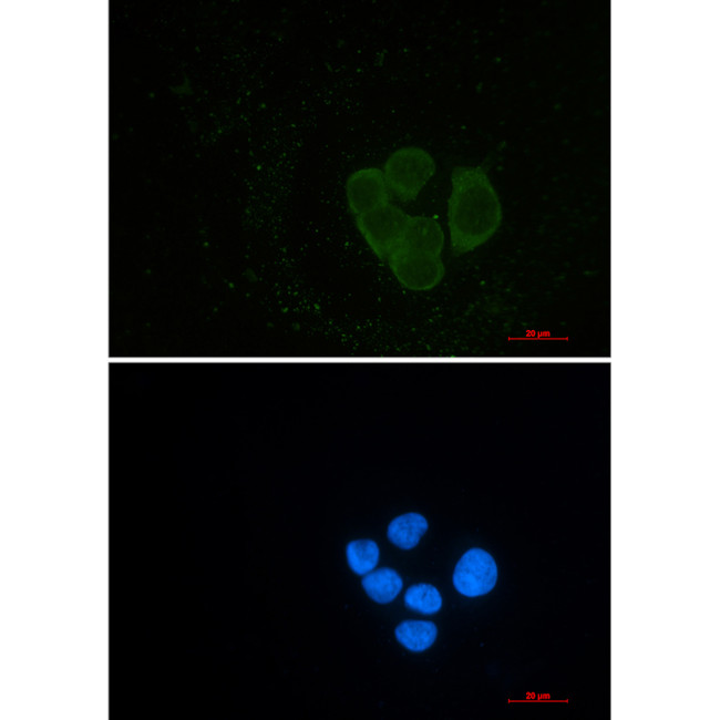 EPS15R Antibody in Immunocytochemistry (ICC/IF)