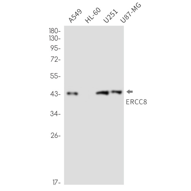 ERCC8 Antibody in Western Blot (WB)