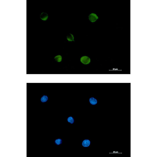 FADS1 Antibody in Immunocytochemistry (ICC/IF)