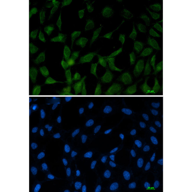Fe65 Antibody in Immunocytochemistry (ICC/IF)