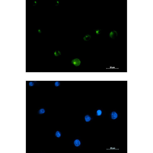 FGFR1OP Antibody in Immunocytochemistry (ICC/IF)