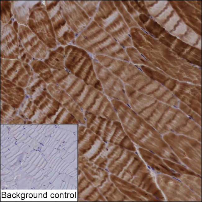FHL1 Antibody in Immunohistochemistry (Paraffin) (IHC (P))