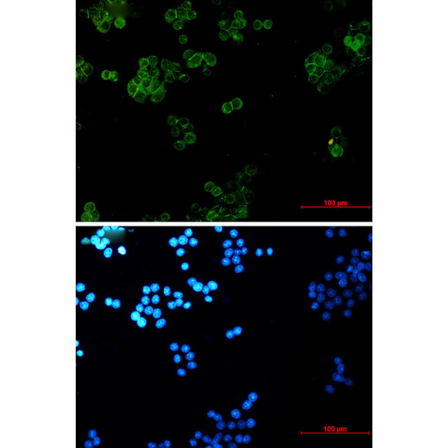 gamma Catenin Antibody in Immunocytochemistry (ICC/IF)