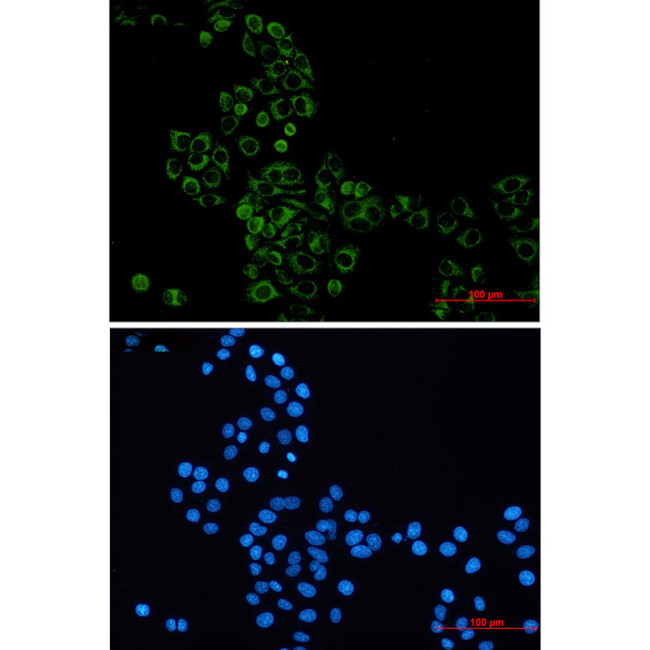 GBP1 Antibody in Immunocytochemistry (ICC/IF)