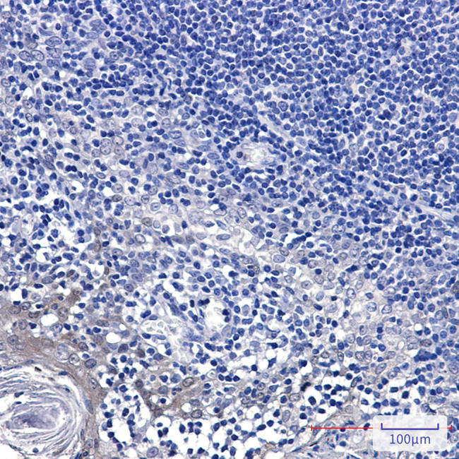 GCLM Antibody in Immunohistochemistry (Paraffin) (IHC (P))