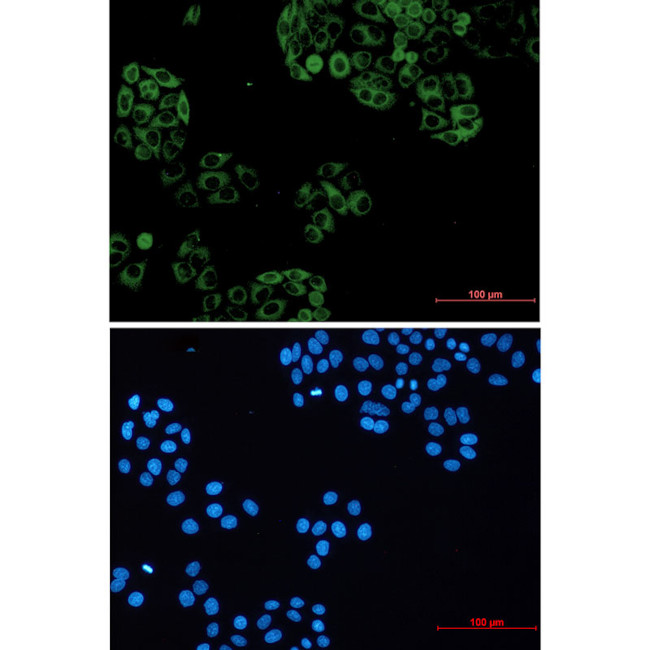 GNAI2 Antibody in Immunocytochemistry (ICC/IF)