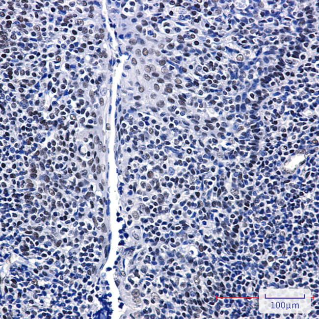 GTPBP4 Antibody in Immunohistochemistry (Paraffin) (IHC (P))