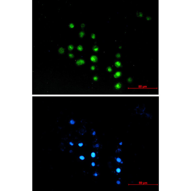HCE Antibody in Immunocytochemistry (ICC/IF)