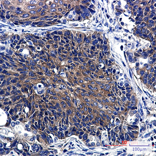 P4HTM Antibody in Immunohistochemistry (Paraffin) (IHC (P))