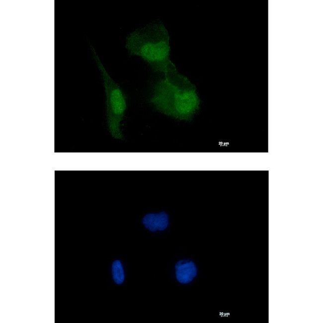 HIF1AN Antibody in Immunocytochemistry (ICC/IF)
