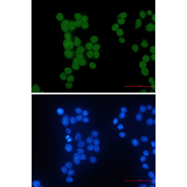 HIPK2 Antibody in Immunocytochemistry (ICC/IF)