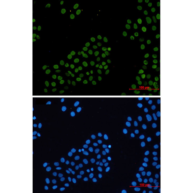 Histone H2A.X Antibody in Immunocytochemistry (ICC/IF)