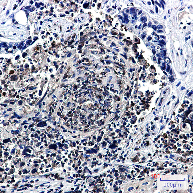 HJURP Antibody in Immunohistochemistry (Paraffin) (IHC (P))
