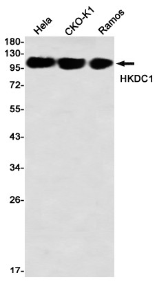 HKDC1 Antibody in Western Blot (WB)