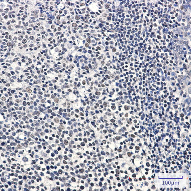 IKZF3 Antibody in Immunohistochemistry (Paraffin) (IHC (P))