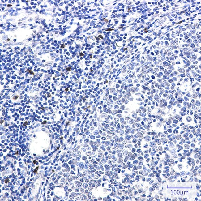 IL-26 Antibody in Immunohistochemistry (Paraffin) (IHC (P))