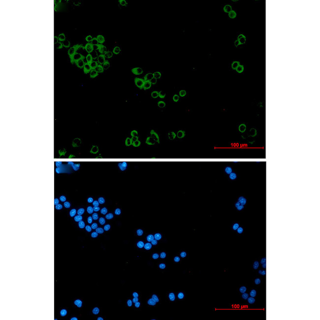 IMPDH2 Antibody in Immunocytochemistry (ICC/IF)