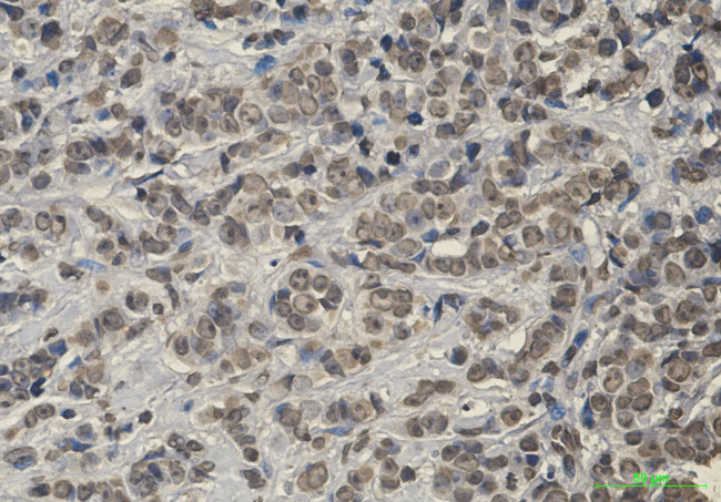 KEAP1 Antibody in Immunohistochemistry (Paraffin) (IHC (P))