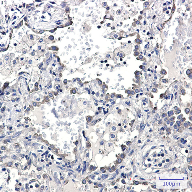 KAP3 Antibody in Immunohistochemistry (Paraffin) (IHC (P))