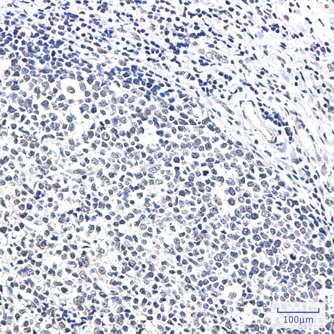 Ku70 Antibody in Immunohistochemistry (Paraffin) (IHC (P))