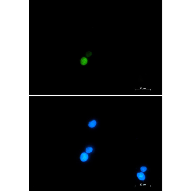 Ku70 Antibody in Immunocytochemistry (ICC/IF)