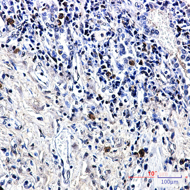 LTK Antibody in Immunohistochemistry (Paraffin) (IHC (P))