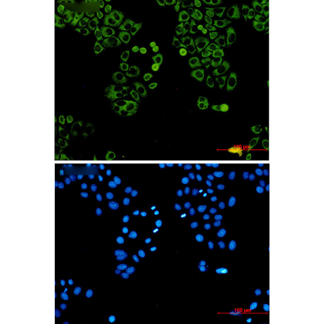 Metadherin Antibody in Immunocytochemistry (ICC/IF)