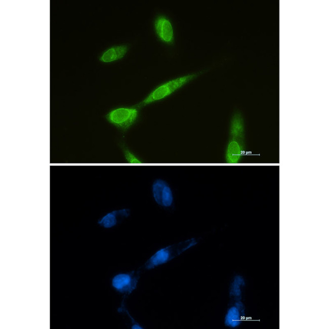 Metadherin Antibody in Immunocytochemistry (ICC/IF)