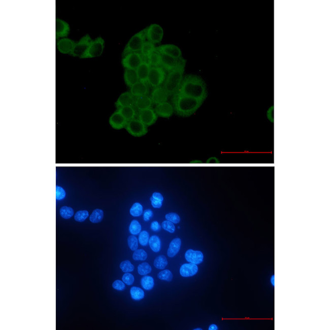 MEK2 Antibody in Immunocytochemistry (ICC/IF)